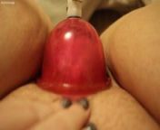 Mega Baby Teil 11 from 11 baby sexvideo