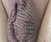The result of male depilation. from male brazilian wax 2