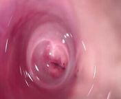 Camera deep inside Mia's creamy pussy, teen Cervix close up from mia cam
